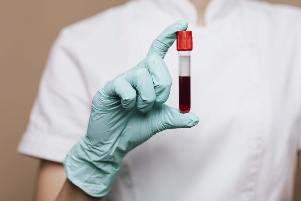 What Does a Phlebotomist Do? (And How to Become One)